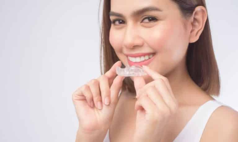 Clear Aligners