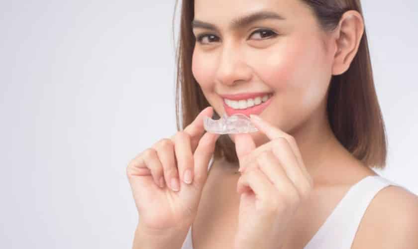 Clear Aligners